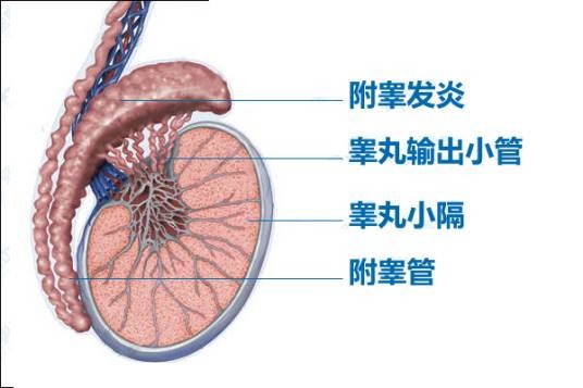 阴囊坠胀痛