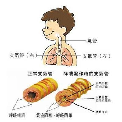 过敏性鼻炎咳嗽