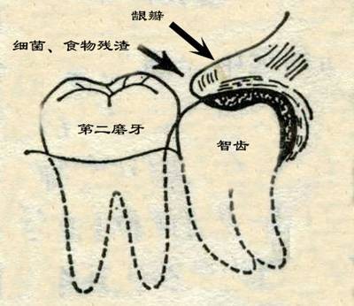 尽根牙