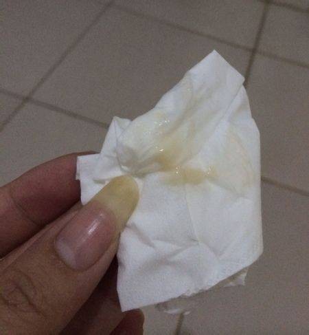 褐色分泌物