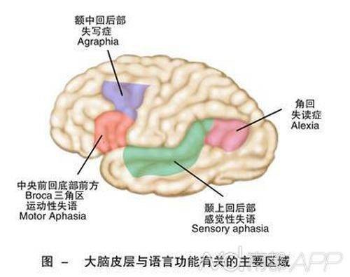 感觉性失语症
