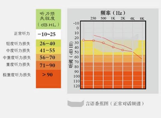 听力损失