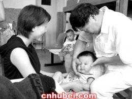 先天性肌斜颈