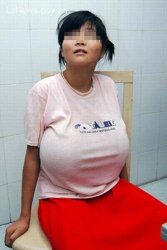 巨乳女孩