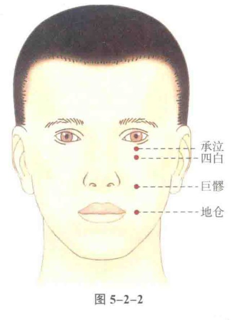 承泣(人体腧穴)
