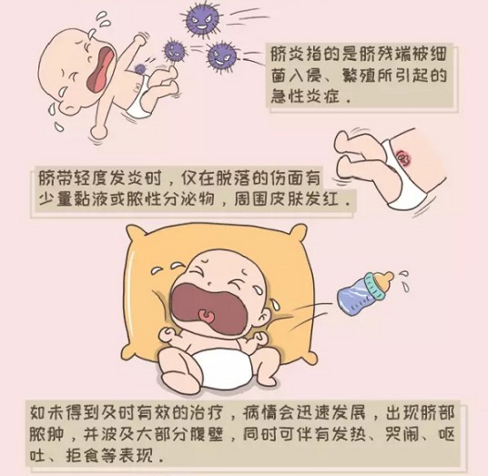 脐带感染
