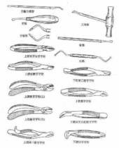 拔牙术