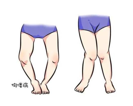 手足搐搦症