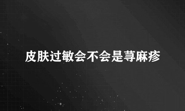 皮肤过敏会不会是荨麻疹