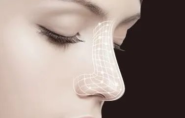 整形隆鼻哪好