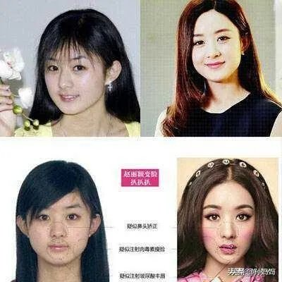 赵丽颖长的漂亮人缘又好,哪部影视是她的成名作?