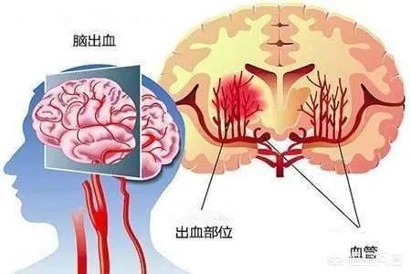 跟70岁老人打篮球危险吗