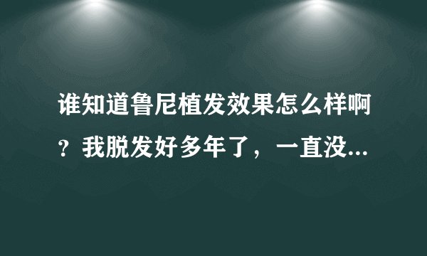 谁知道鲁尼植发效果怎么样啊？我脱发好多年了，一直没...