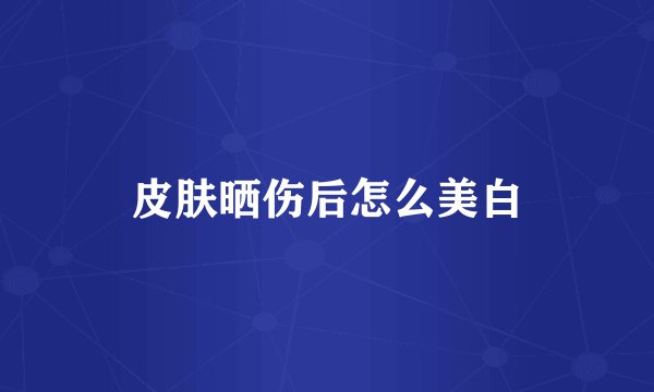 皮肤晒伤后怎么美白