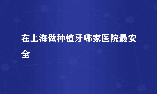 在上海做种植牙哪家医院最安全