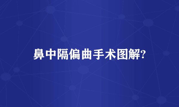 鼻中隔偏曲手术图解?