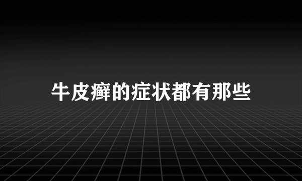 牛皮癣的症状都有那些