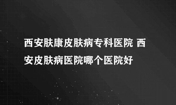西安肤康皮肤病专科医院 西安皮肤病医院哪个医院好