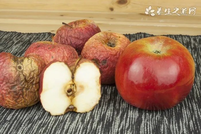 白癜风传染吗？