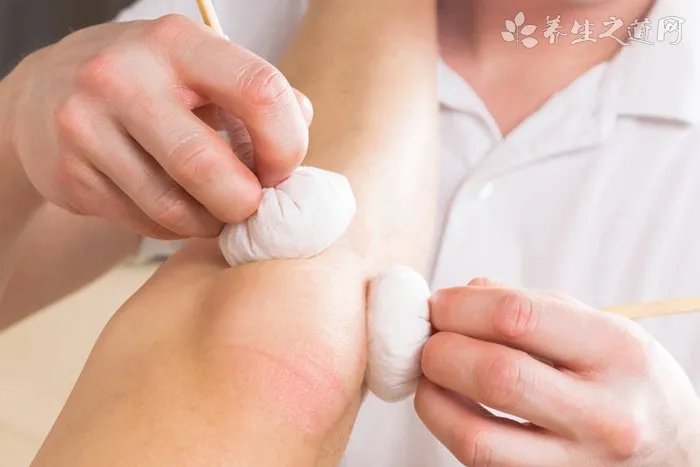 子痫