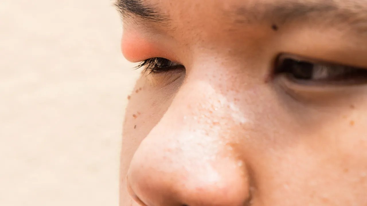 右眼跳是什么意思？
