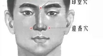 迎香穴在哪个位置图解