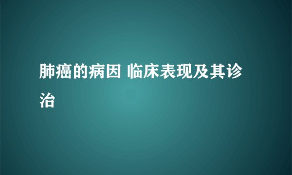 肺癌的病因 临床表现及其诊治