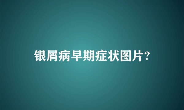 银屑病早期症状图片?