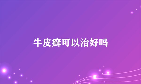 牛皮癣可以治好吗