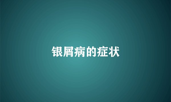 银屑病的症状