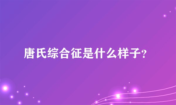 唐氏综合征是什么样子？