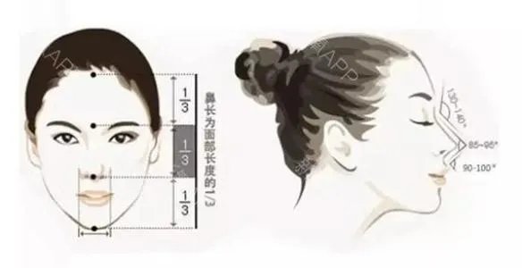 做鼻子整形要多少钱