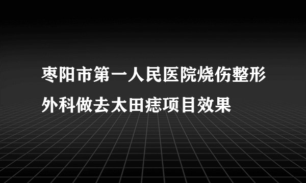 枣阳市第一人民医院烧伤整形外科做去太田痣项目效果