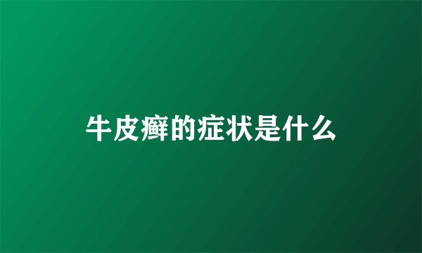 牛皮癣的症状是什么