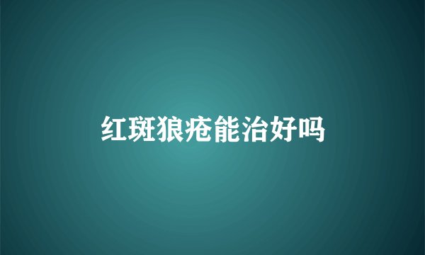 红斑狼疮能治好吗