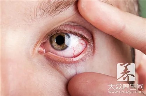 现在眼睛做激光多少钱