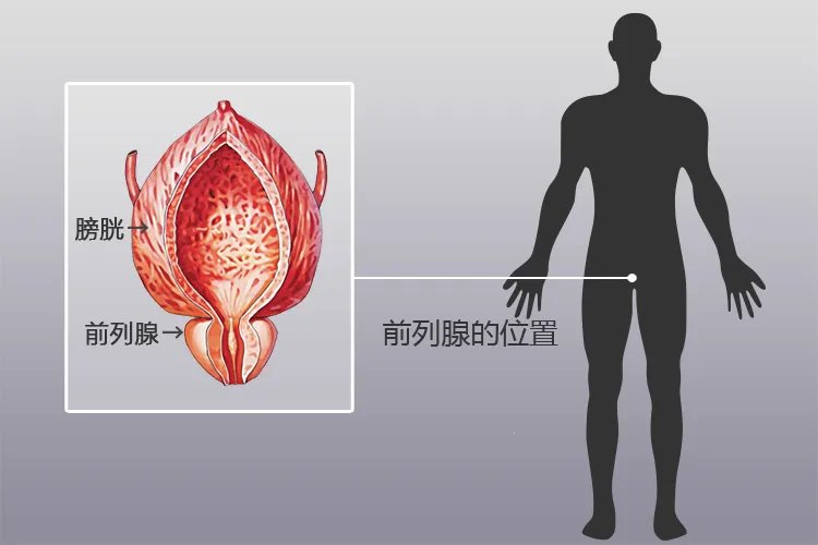 前列腺图片