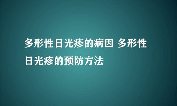 多形性日光疹的病因 多形性日光疹的预防方法