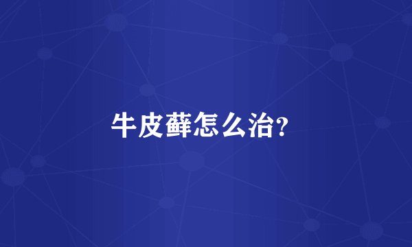 牛皮藓怎么治？