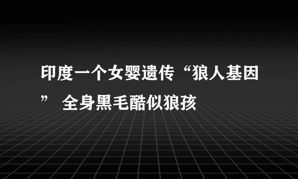 印度一个女婴遗传“狼人基因” 全身黑毛酷似狼孩