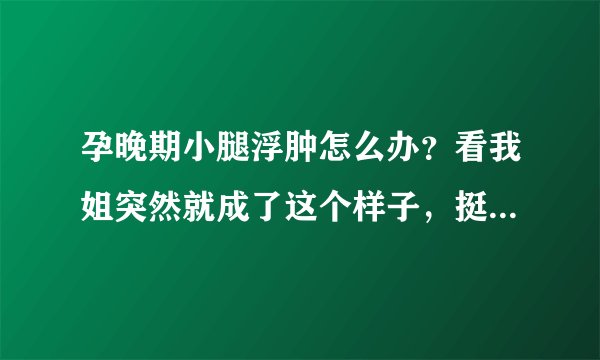 孕晚期小腿浮肿怎么办？看我姐突然就成了这个样子，挺着急的，...