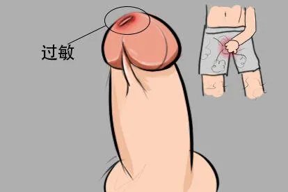 尿道口红肿是什么原因图片