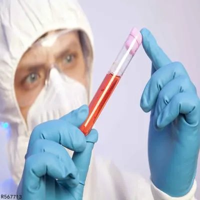 萎缩性鼻炎检查项目有哪些