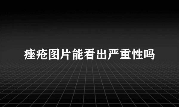 痤疮图片能看出严重性吗