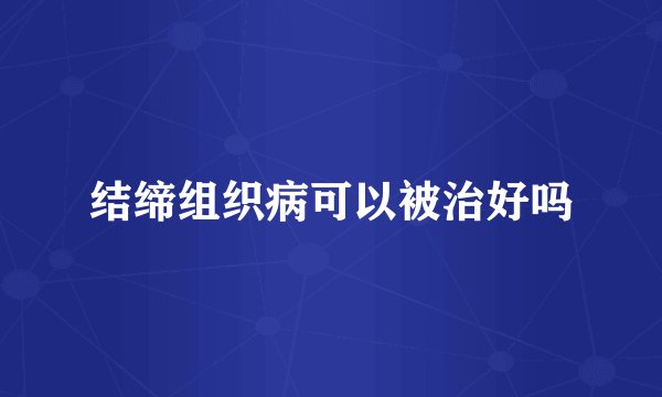 结缔组织病可以被治好吗