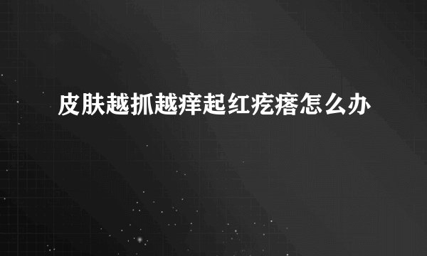皮肤越抓越痒起红疙瘩怎么办