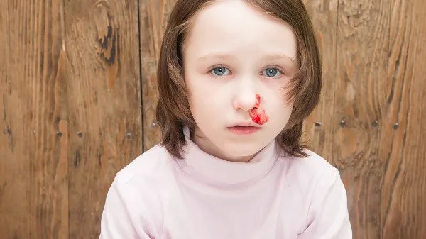 小孩流鼻血怎么办