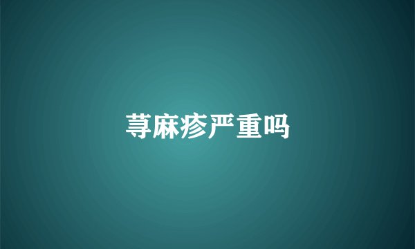 荨麻疹严重吗