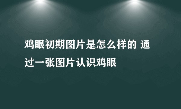 鸡眼初期图片是怎么样的 通过一张图片认识鸡眼