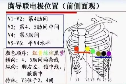 胸导联位置示意图